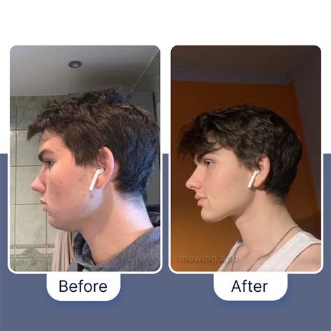 mewing results|how to mewing.